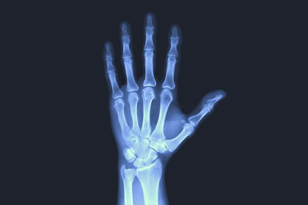 Benefícios do DICOM na radiologia